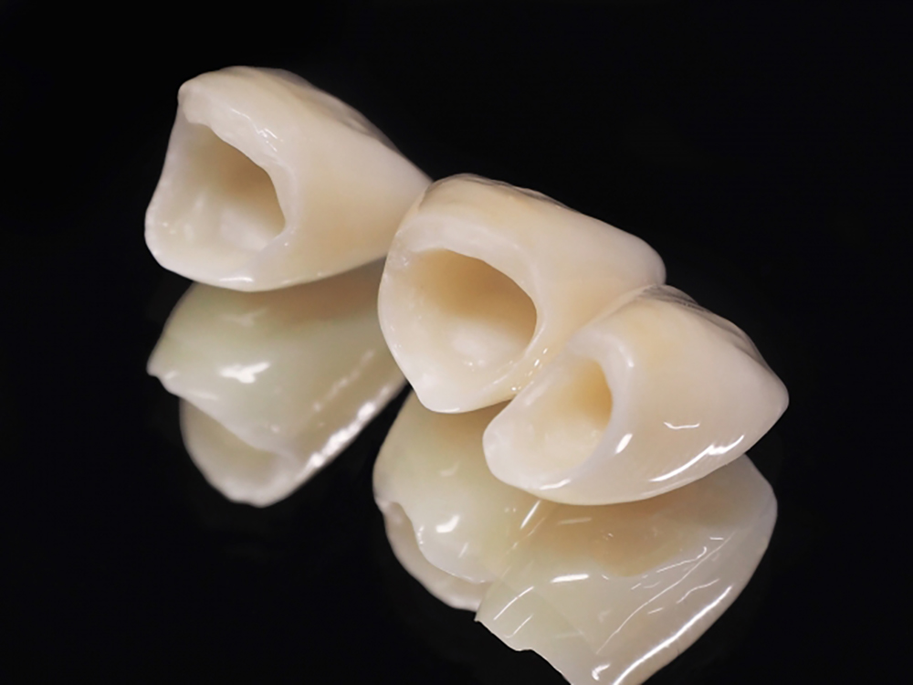 フルジルコニア